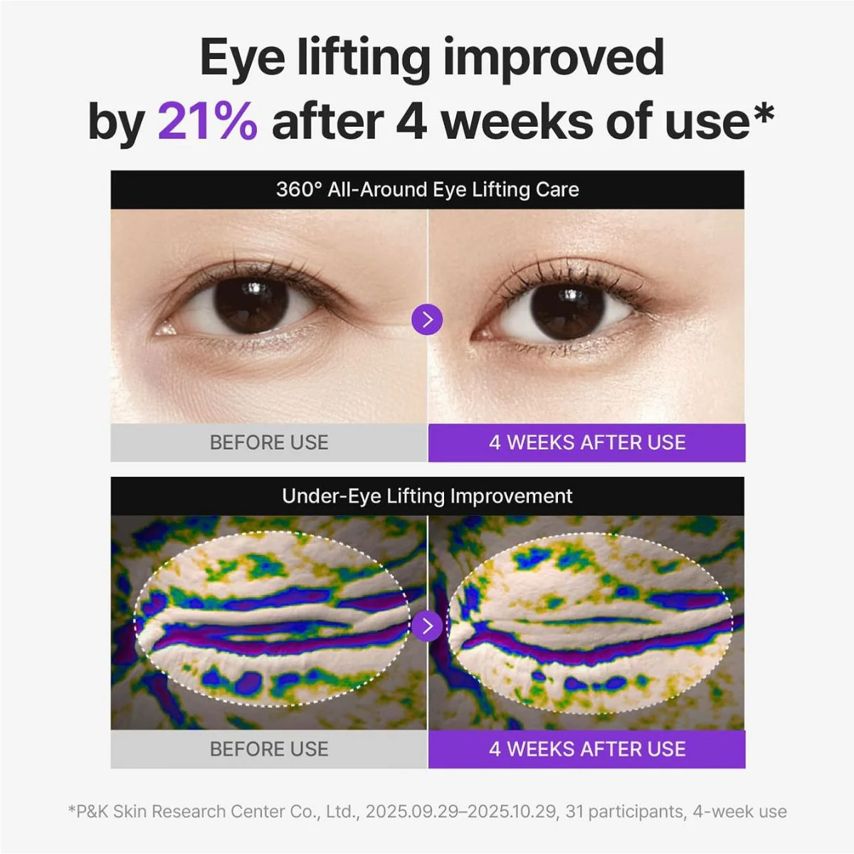 360º Shot PDRN Lifting Eye Cream 30mL - Image 5