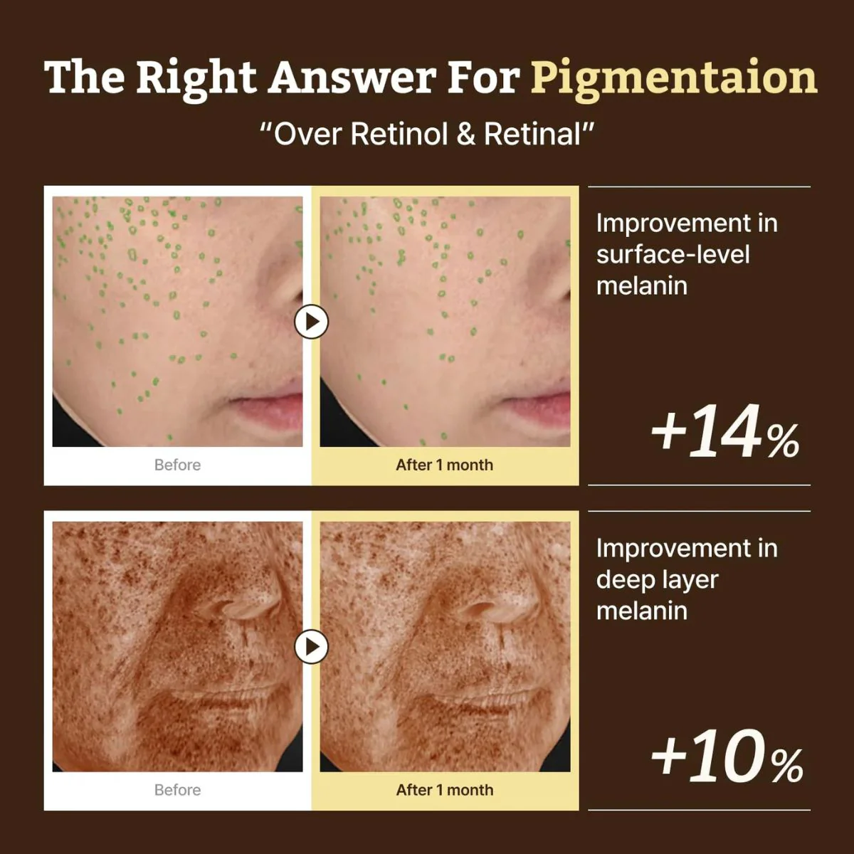 Advanced Retino-Mela Serum 30mL - Image 5