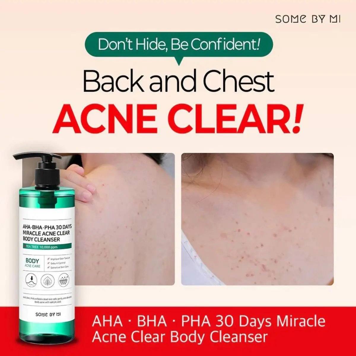 AHA BHA PHA 30 Days Miracle Clear Body Cleanser 400g - Image 4