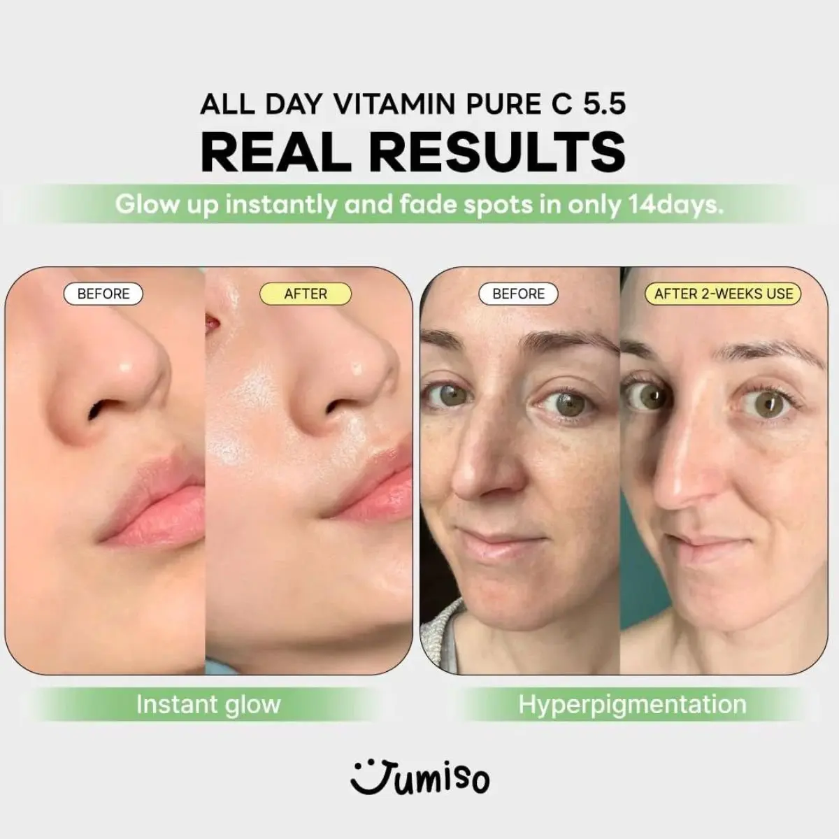 All Day Vitamin Pure C 5.5 Glow Serum 30mL - Image 3
