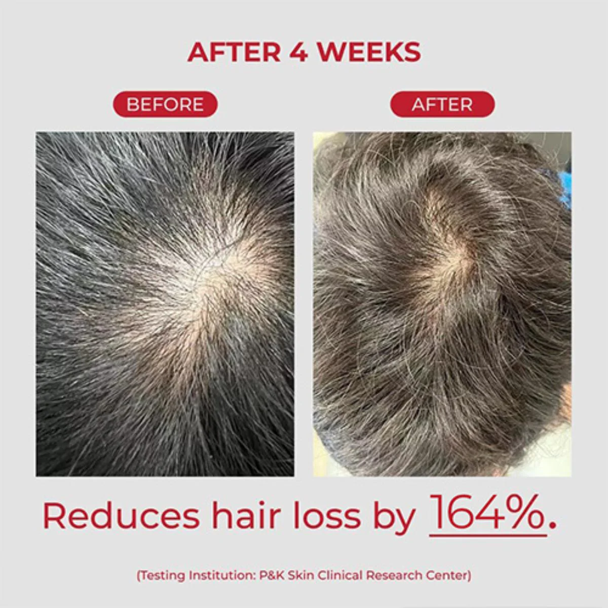 Annurcatin Shampoo 525mL - Image 3