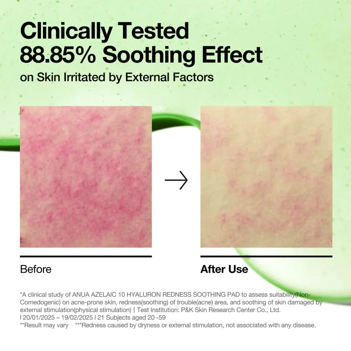 Azelaic Acid 10 Hyaluron Redness Soothing Pad 90ea - Image 5