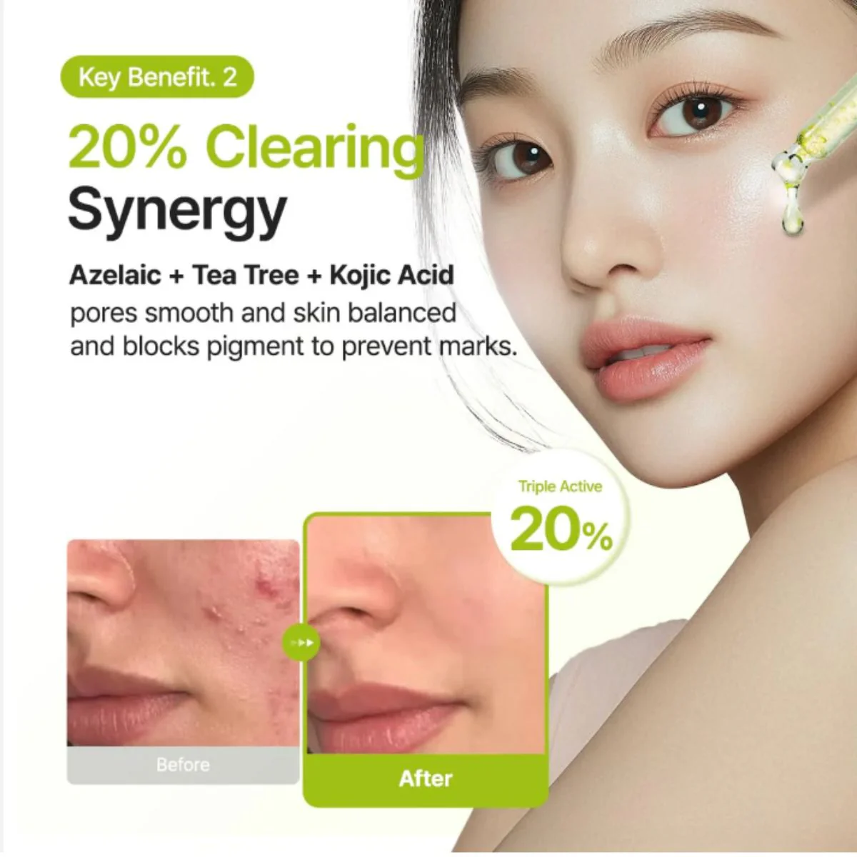 Azelaic Acid 10 Kojic Azulene Serum 30mL - Image 3
