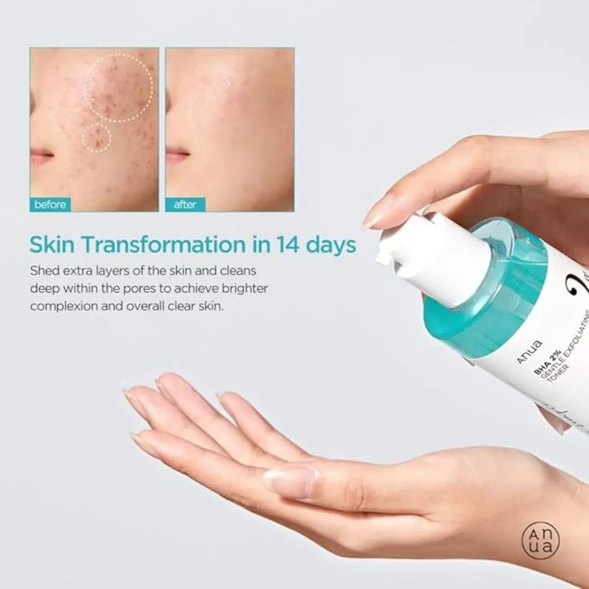 BHA 2% Gentle Exfoliating Toner 150mL - Image 3