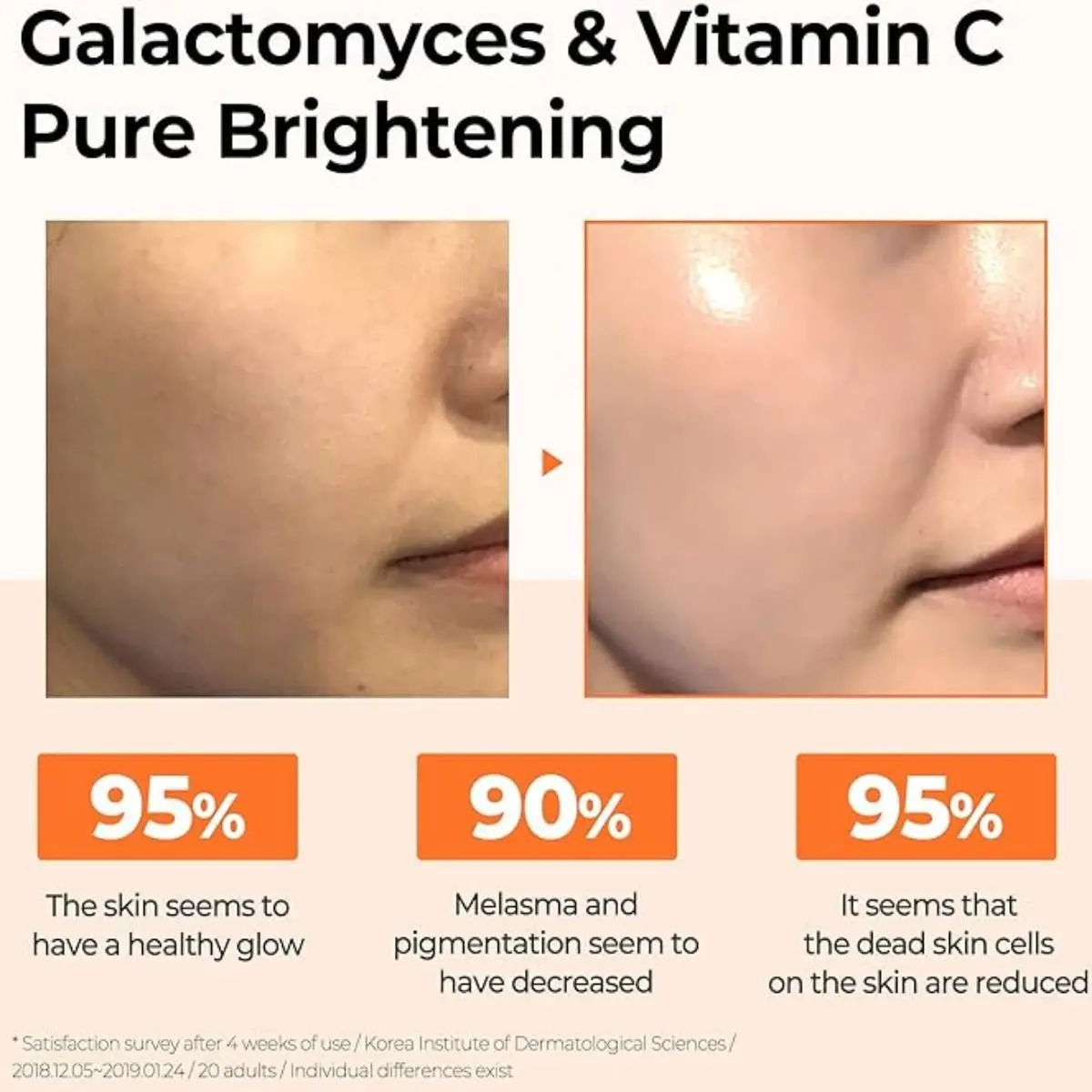 Galactomyces Pure Vitamin C Glow Serum 30mL - Image 4