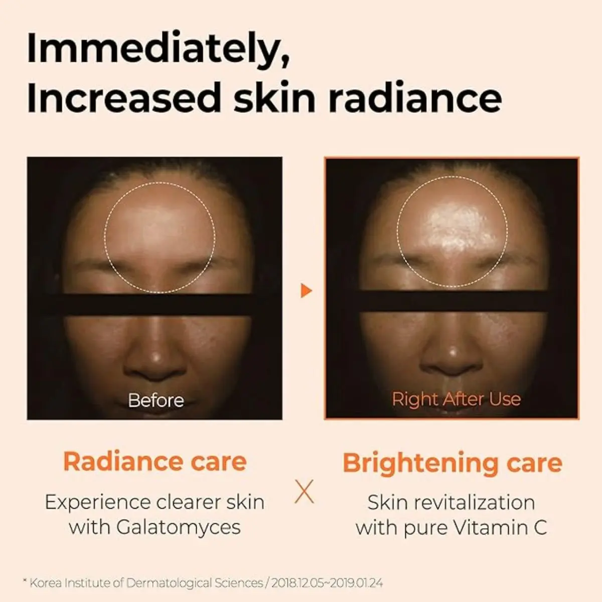 Galactomyces Pure Vitamin C Glow Serum 30mL - Image 5