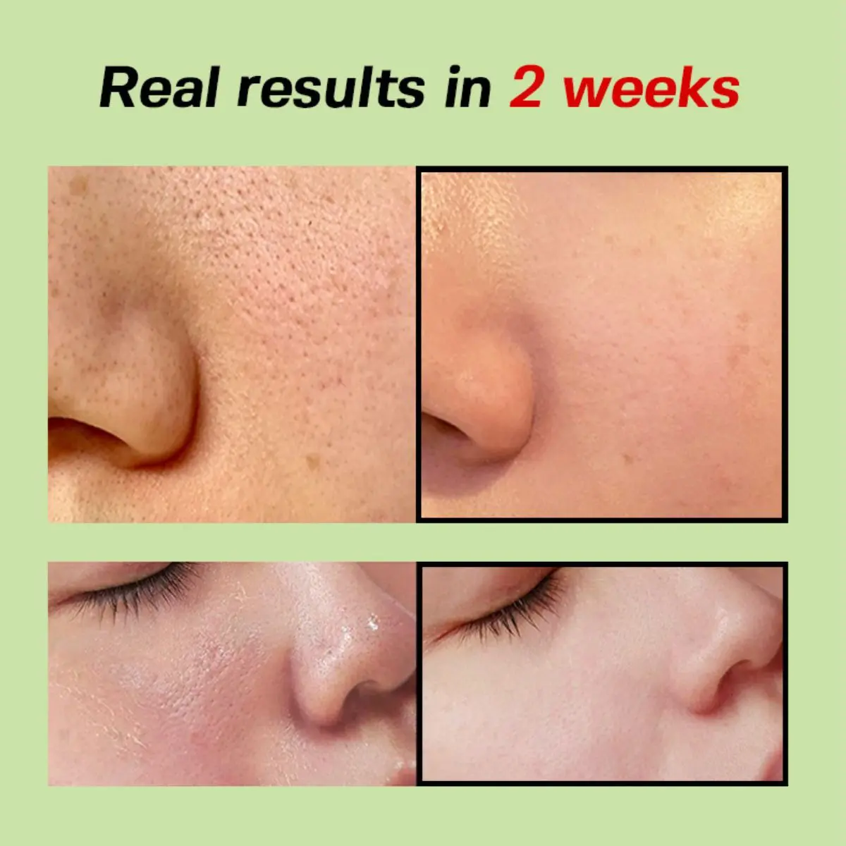 Green Tomato Pore Lifting Ampoule+ 30mL - Image 5