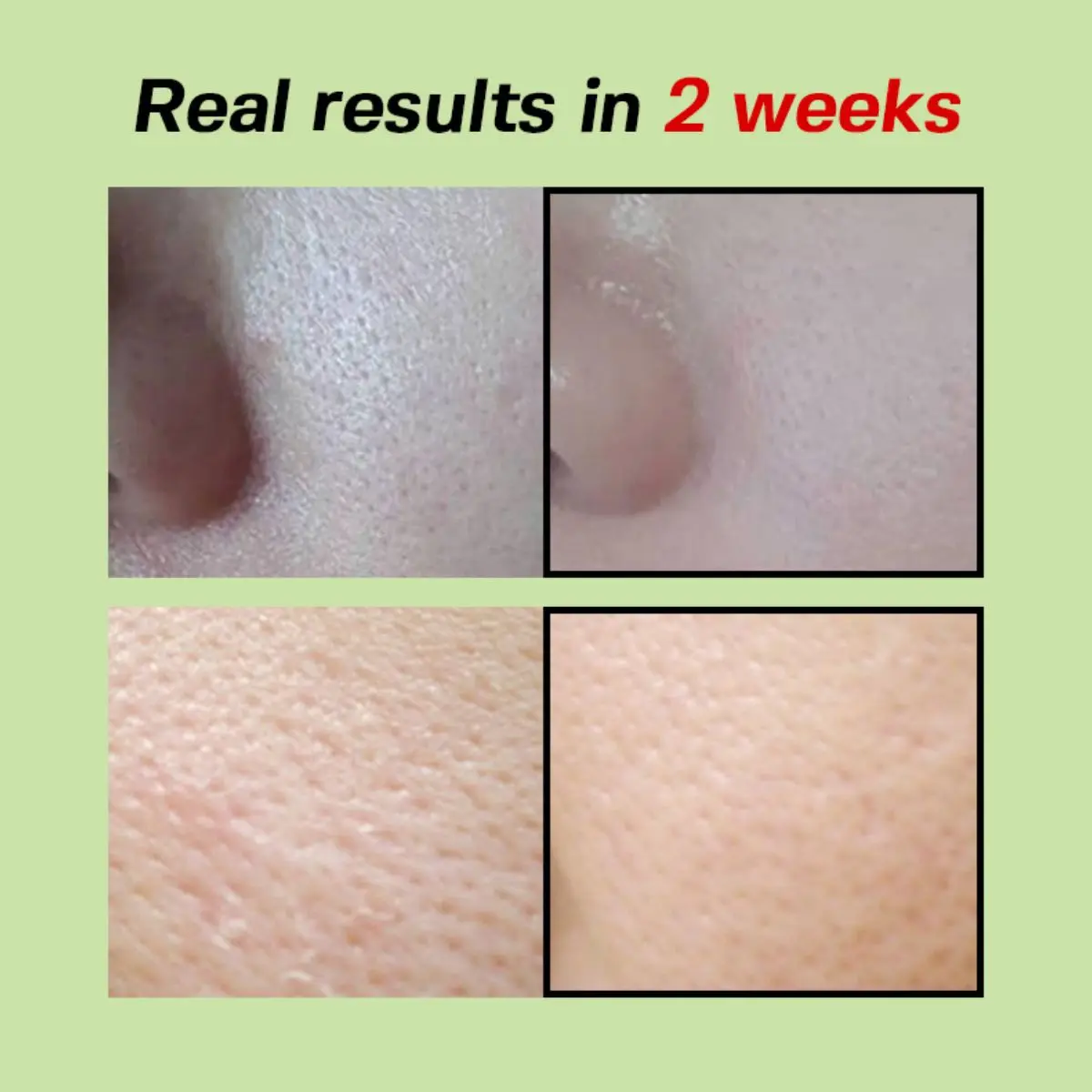 Green Tomato Pore Lifting Ampoule+ 30mL - Image 6