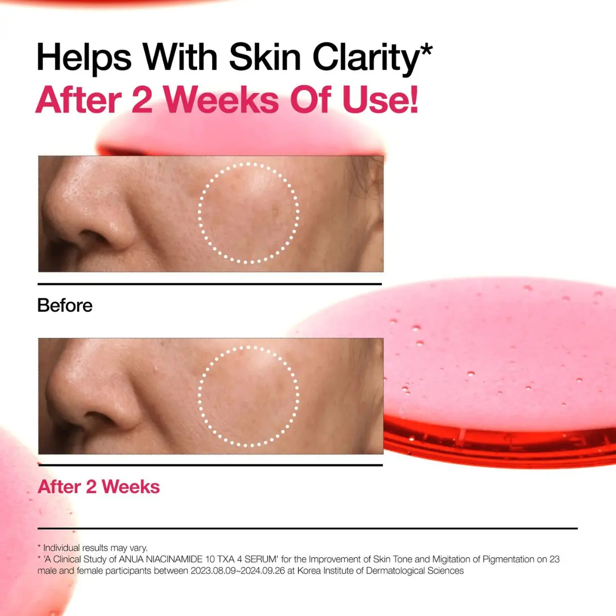 Niacinamide 10% + TXA 4% Serum 30mL - Image 3