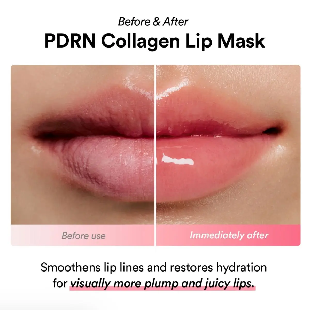 PDRN Collagen Lip Mask Glazed Jelly 11g - Image 5