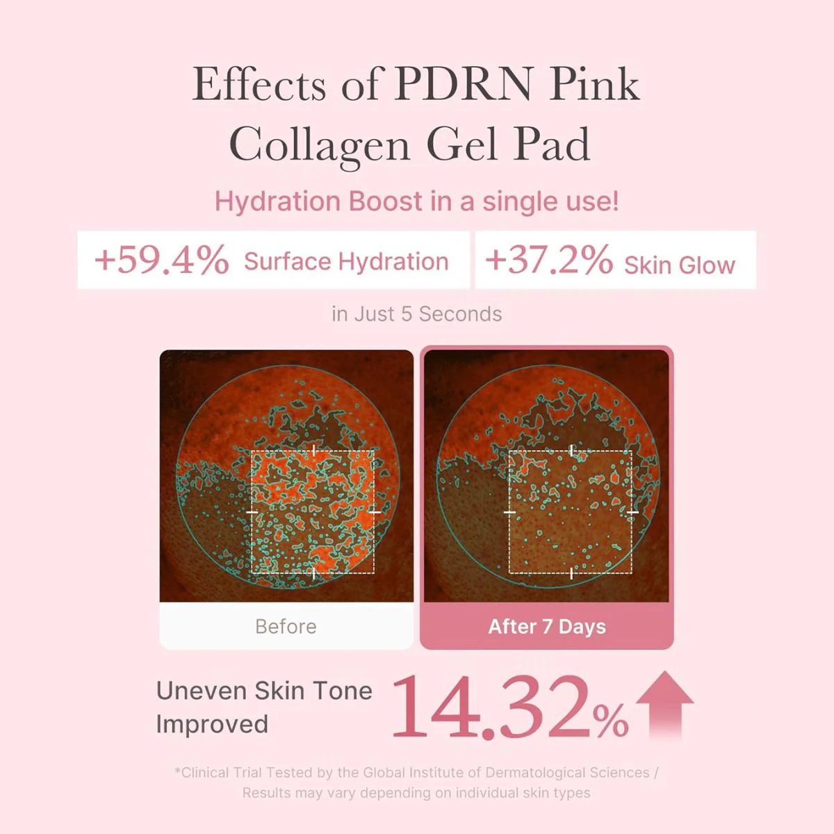 PDRN Pink Collagen Toning Gel Toner Pad 70ea - Image 4
