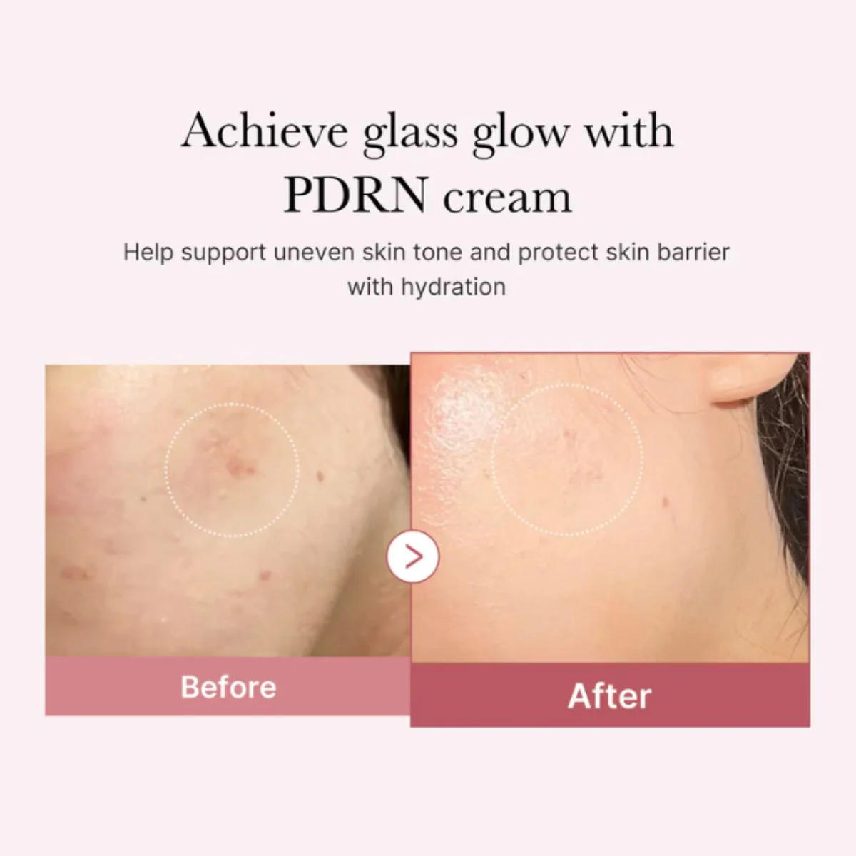 PDRN Pink Hyaluronic Moisturizing Cream 50mL - Image 4