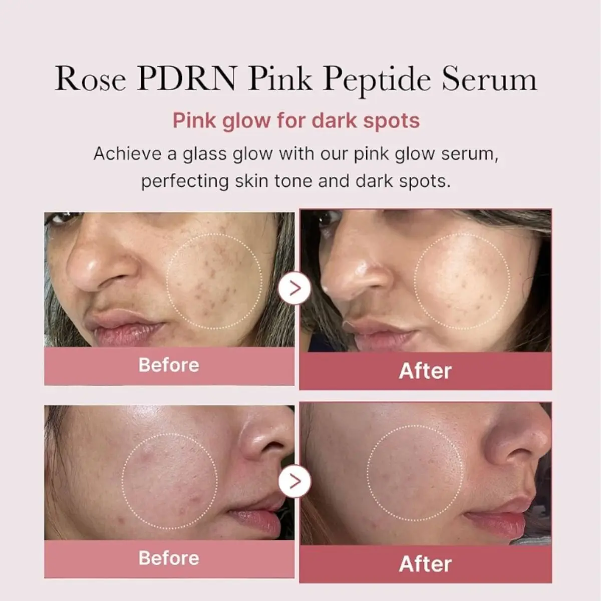 PDRN Pink Peptide Serum 30mL - Image 3