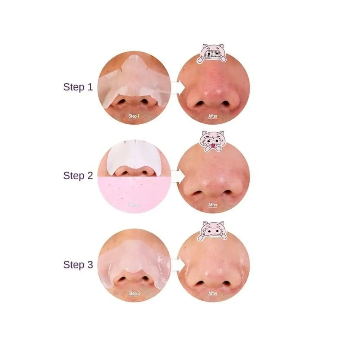 Pig Nose Clear Blackhead 3 Step Kit - Image 3
