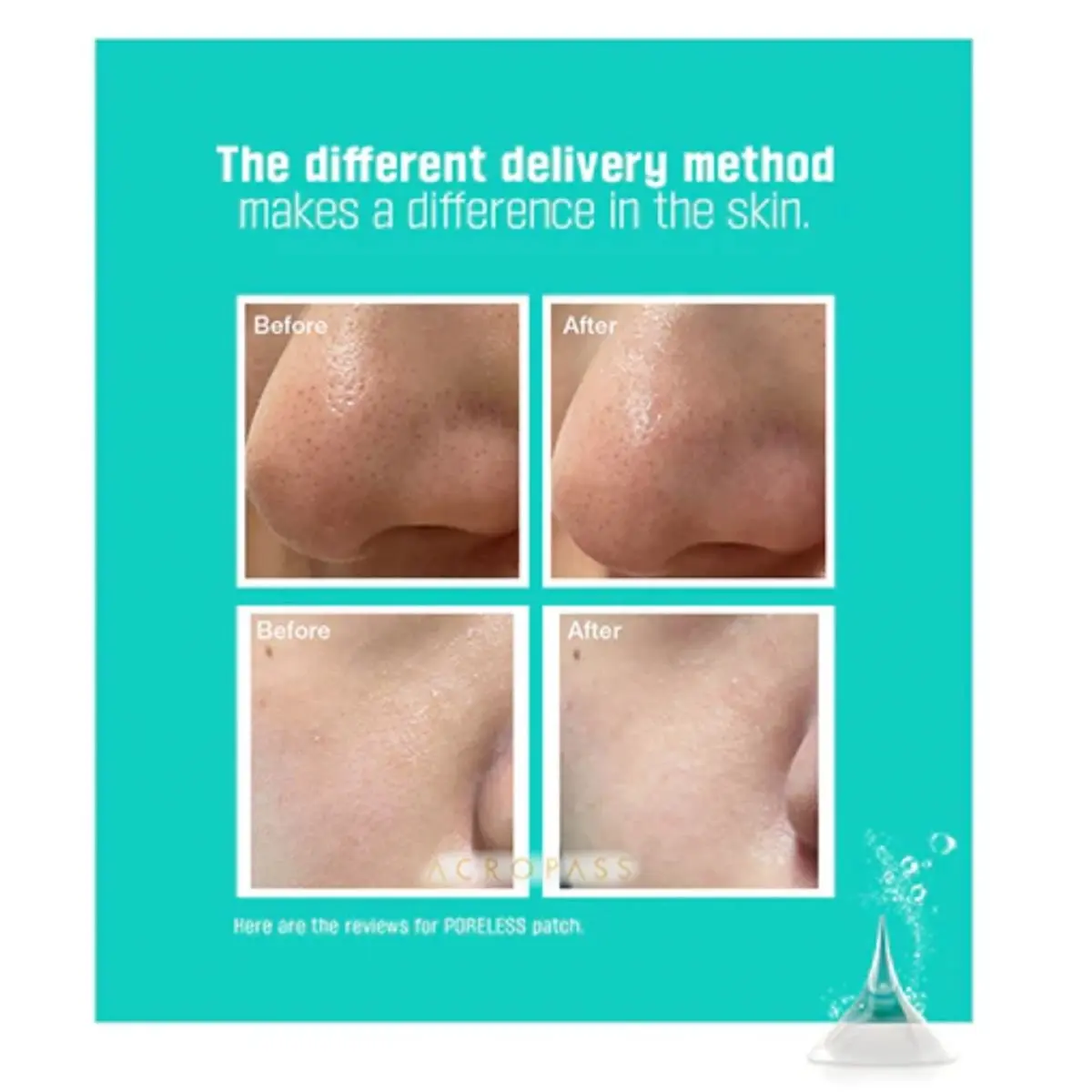 Poreless Patch - Image 4