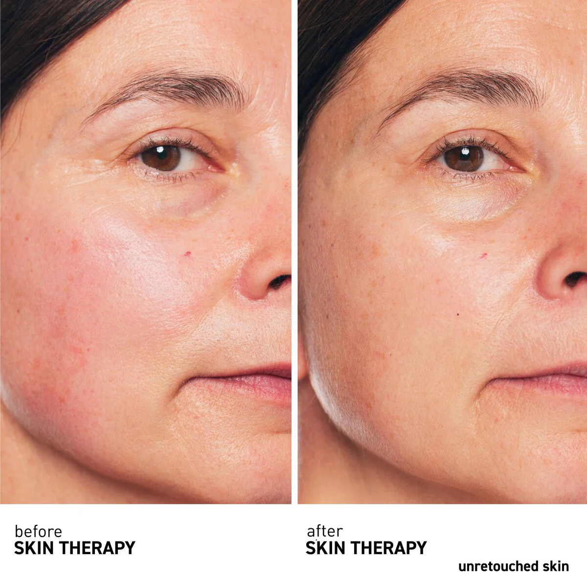 Skin Therapy Lacté 30mL - Image 3