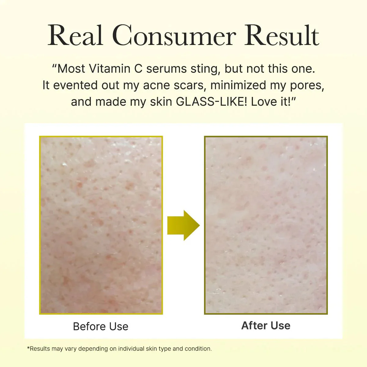 Vitamin C Booster Shot 30mL - Image 8