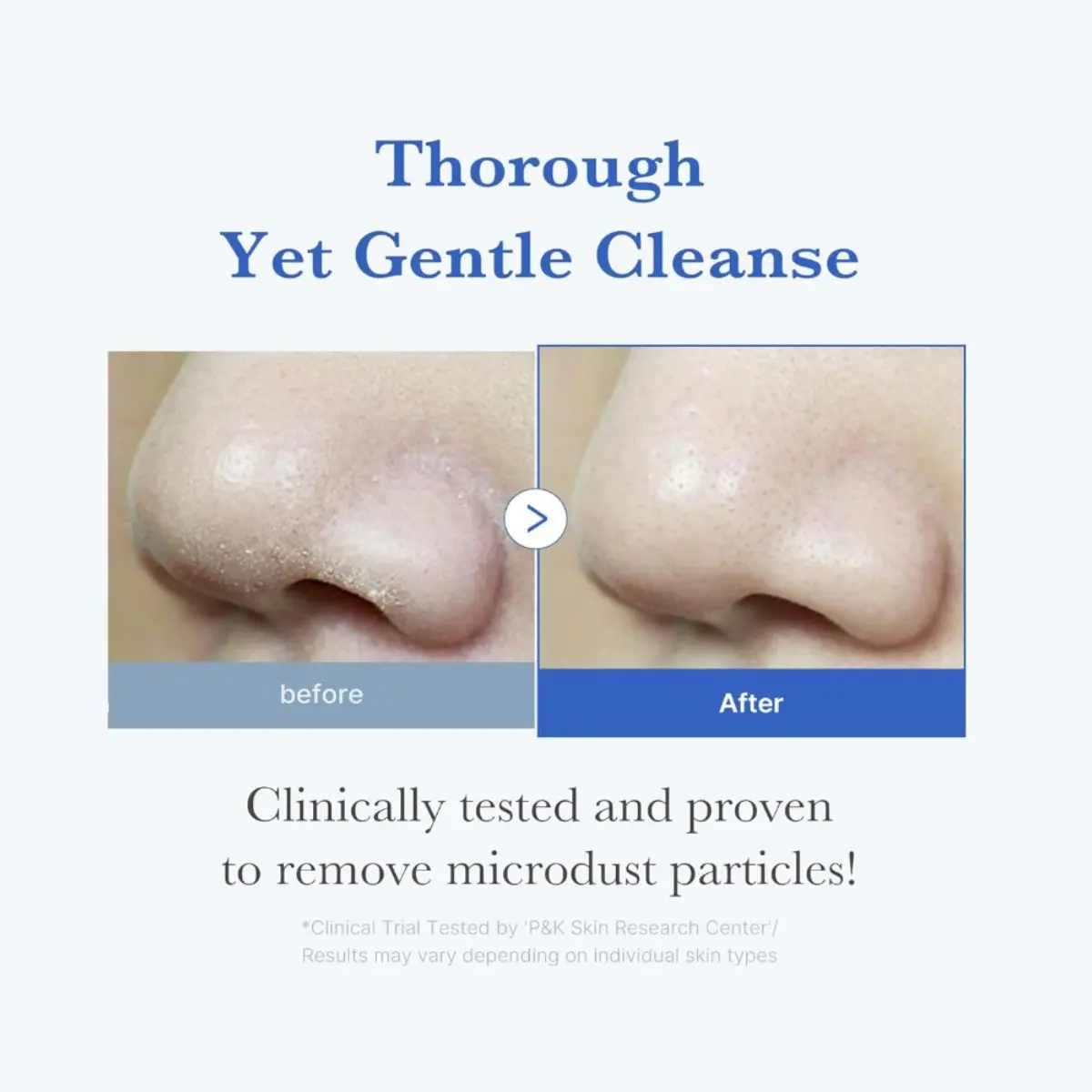 Zero Foam Cleanser 120g - Image 4