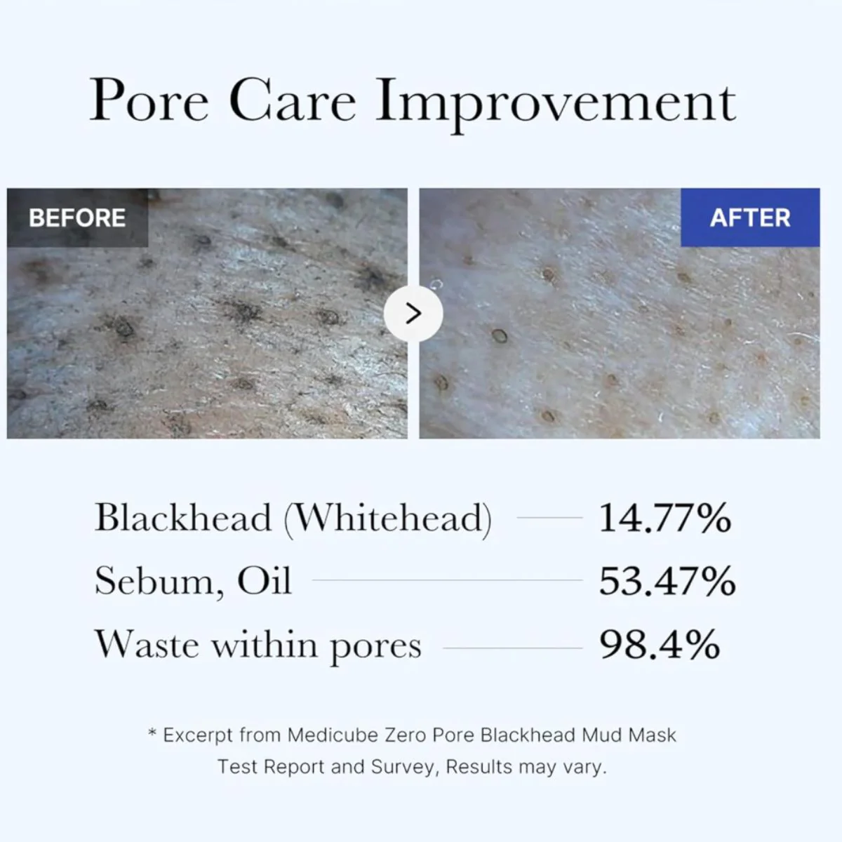 Zero Pore Blackhead Mud Mask 100g - Image 4